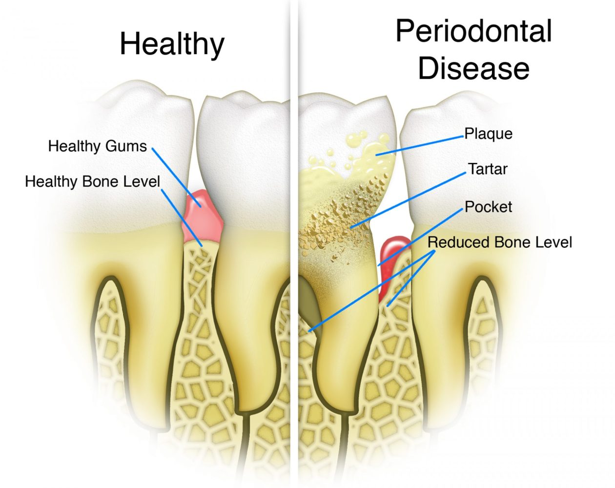 gum disease dentist silver spring maryland