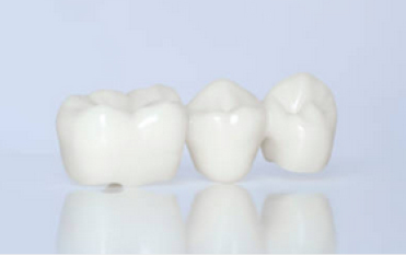 Dental crown special offer.