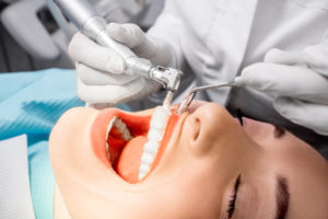 teeth-cleaning-dentist-silver-spring-maryland